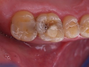 1 d16 alku ym 124.jpg