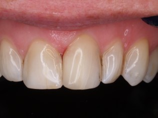 d21 klik FS XTE 014311.JPG