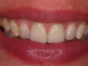 d21 valmis klick 58.JPG